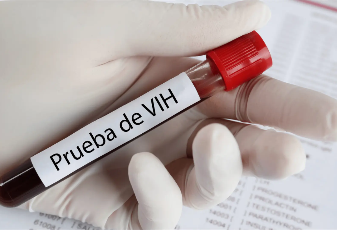 prueba-vih-veracruz.png
