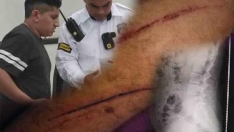 Tránsito fue complice y dejó ir a conductor que atropelló a motociclista en el Puerto