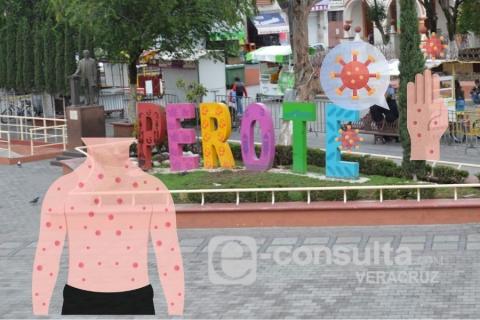 ¿Qué es el virus coxsackie que afecta a comunidades de Perote?