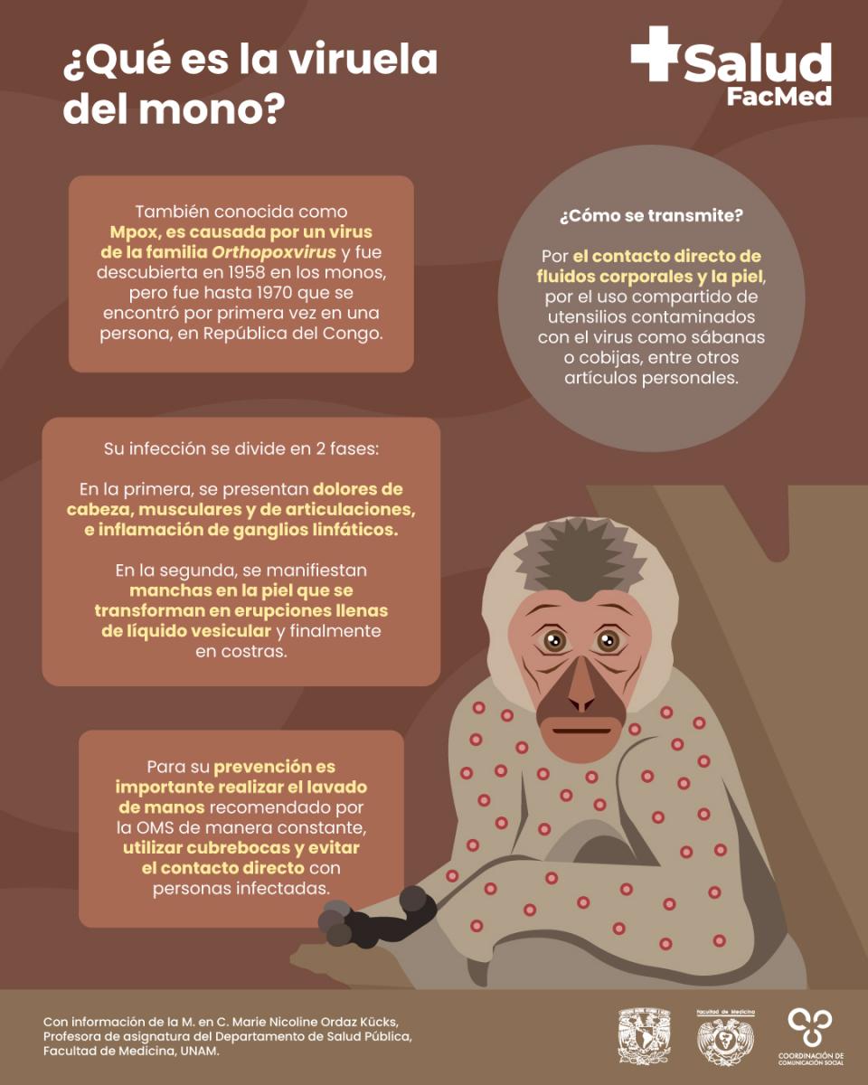 viruela_del_mono-imss-veracruz.jpg