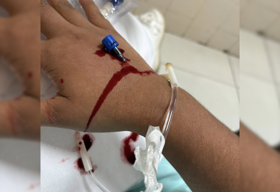 explosion-uv-imss.png