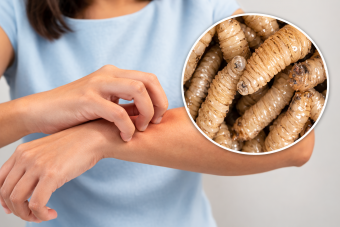 Gusano Barrenador Casos Veracruz 