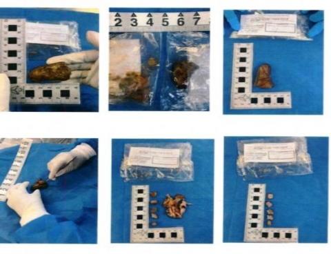 No había ningún dedo humano en tamal de Boca del Río