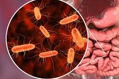 Brote de diarrea en Tatahuicapan: así son efectos de bacteria E.Coli
