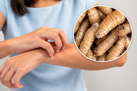 Gusano Barrenador Casos Veracruz 