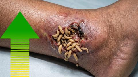 gusano barrenador, municipios, Veracruz