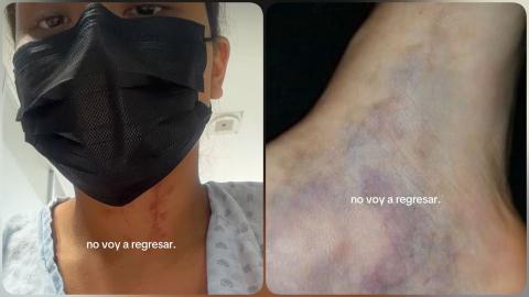 “Me dejó inconsciente”: xalapeña expone violencia de su expareja