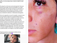 Detienen a Carlos N, presunto agresor de Sulma Escobar en Xalapa 