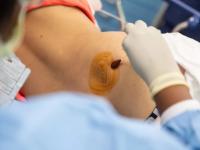 Madres piden pago de estudios de médula ósea en Torre Pediátrica