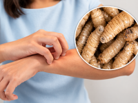 Gusano Barrenador Casos Veracruz 