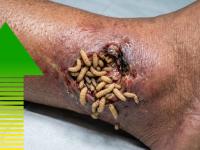 gusano barrenador, municipios, Veracruz